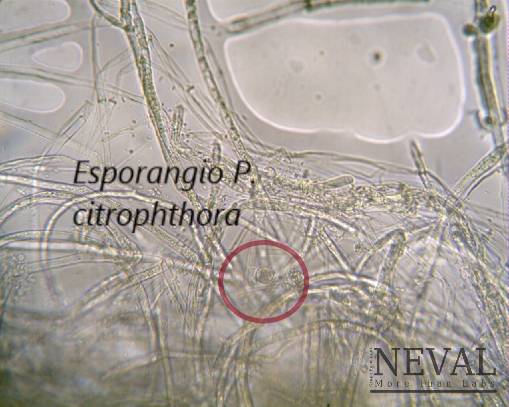 phytophtora microscopio