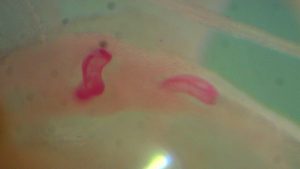 Meloidogyne spp. 